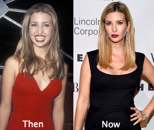 Ivanka Trump has changed in appearance over the years