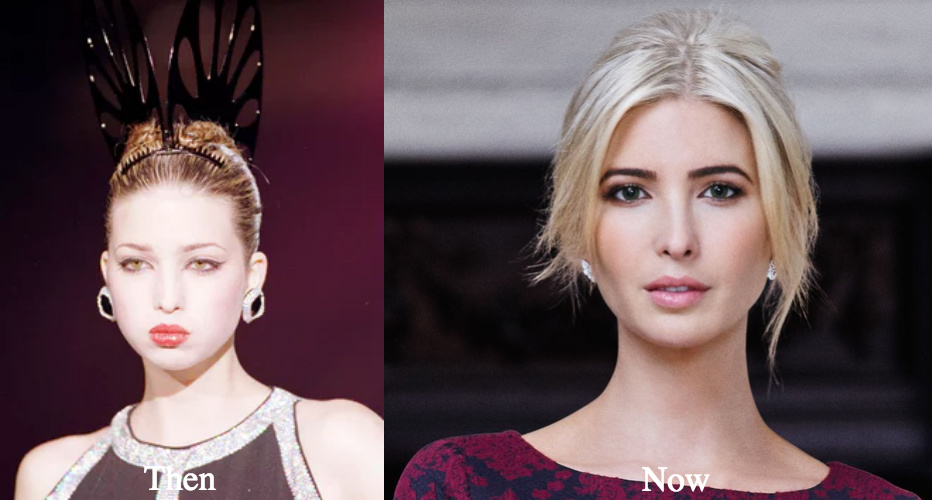ivanka-trump-before-and-after