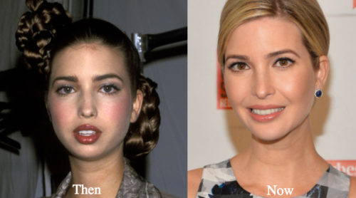 Ivanka Trump Plastic Surgery Before and After Photos