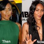 Jada Pinkett Smith Plastic Surgery Before and After Photos