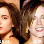 Kate Beckinsale Plastic Surgery Before and After Photos