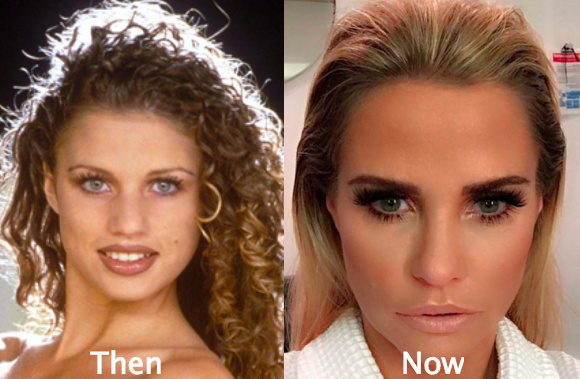 Why do people get plastic surgery?