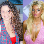 Katie Price Plastic Surgery Before and After Photos