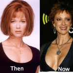 Lauren Holly Plastic Surgery Before and After Photos