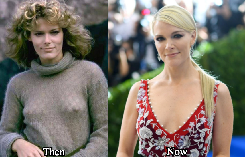 Megyn Kelly boob job before and after photos