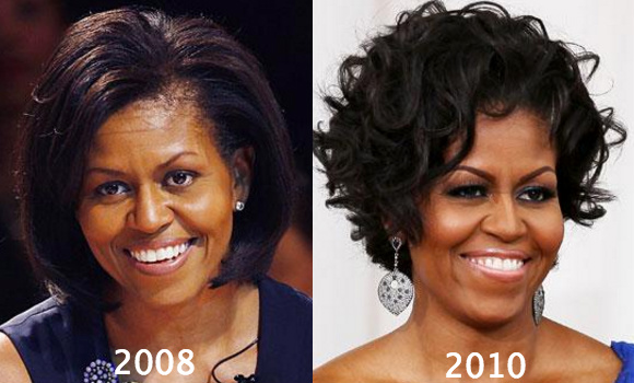 Michelle Obama Plastic Surgery rumors