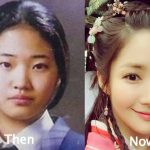 Park Min Young Plastic Surgery Before and After Photos