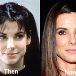 Sandra Bullock Plastic Surgery Before and After Photos