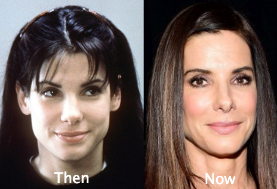 Did Sandra Bullock undergo plastic surgery?
