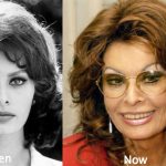 Sophia Loren Plastic Surgery Before and After Photos