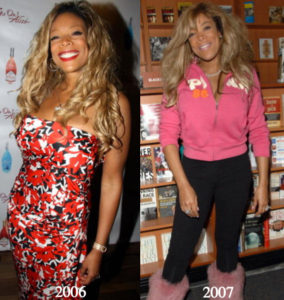 Wendy Williams Plastic Surgery Before and After Photos