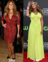 Wendy Williams Plastic Surgery Before and After Photos