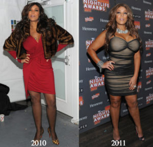 Wendy Williams Plastic Surgery Before and After Photos