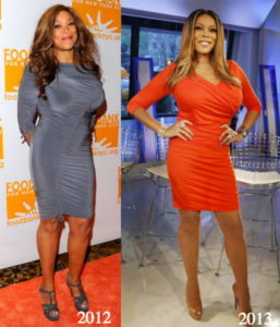Wendy Williams Plastic Surgery Before and After Photos