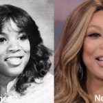 Wendy Williams Plastic Surgery Before and After Photos
