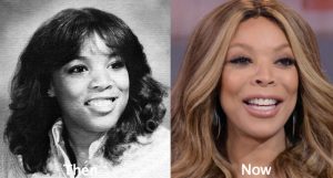 Wendy Williams Plastic Surgery Before and After Photos