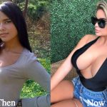 Anastasiya Kvitko Plastic Surgery Before and After Photos