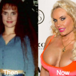 Coco Austin Plastic Surgery Before and After Photos