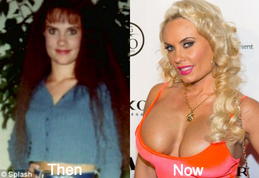 Coco Austin plastic surgery before and after