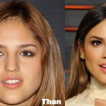 Eiza Gonzalez Plastic Surgery Before and After Photos