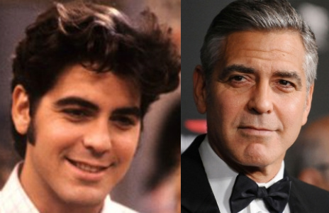 George Clooney plastic surgery before and after photo