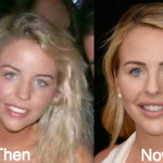 Lydia Bright Plastic Surgery Before and After Photos