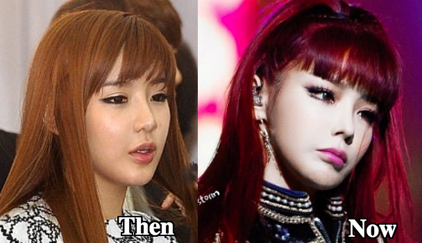 Park Bom plastic surgeries made her look worse