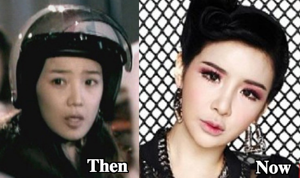 Park Bom plastic surgery before and after shots