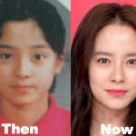 Song Ji Hyo Plastic Surgery Before and After Photos