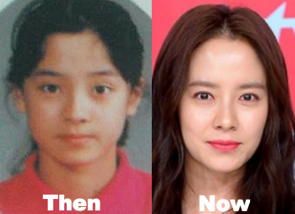 Song Ji Hyo plastic surgery before and after photos