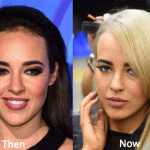 Stephanie Davis Plastic Surgery Before and After Photos