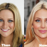 Stephanie Pratt Plastic Surgery Before and After Photos