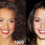 Jessica Alba Plastic Surgery Before and After Photos