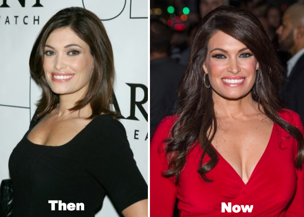 Kimberly Guilfoyle plastic surgery before and after photos