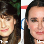 Kyle Richards Plastic Surgery Before and After Photos