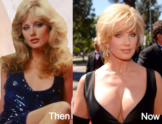 Morgan Fairchild plastic surgery before and after photos