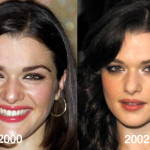 Rachel Weisz Plastic Surgery Before and After Photos