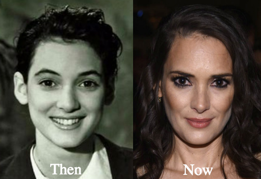 Winona Ryder Plastic Surgery Before and After Photos