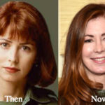 Dana Delany Plastic Surgery Before and After Photos