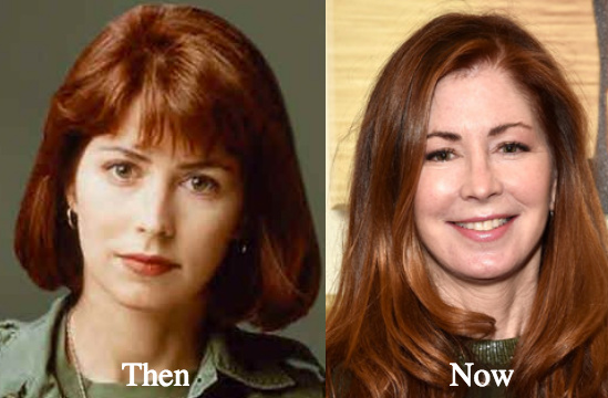 Dana Delany plastic surgery before and after photos