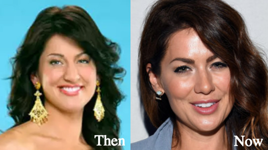 Jillian Harris nose job before and after