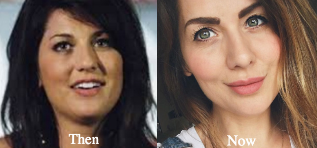 Jillian Harris plastic surgery before and after photos