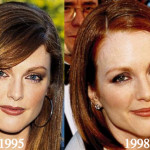Julianne Moore Plastic Surgery Before and After Photos