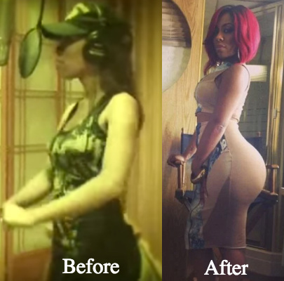 K Michelle Plastic Surgery Before and After Photos