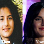 Katrina Kaif Plastic Surgery Before and After Photos