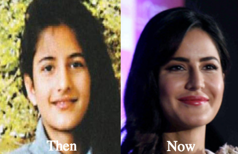 Katrina Kaif plastic surgery before and after photos