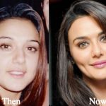 Preity Zinta Plastic Surgery Before and After Photos