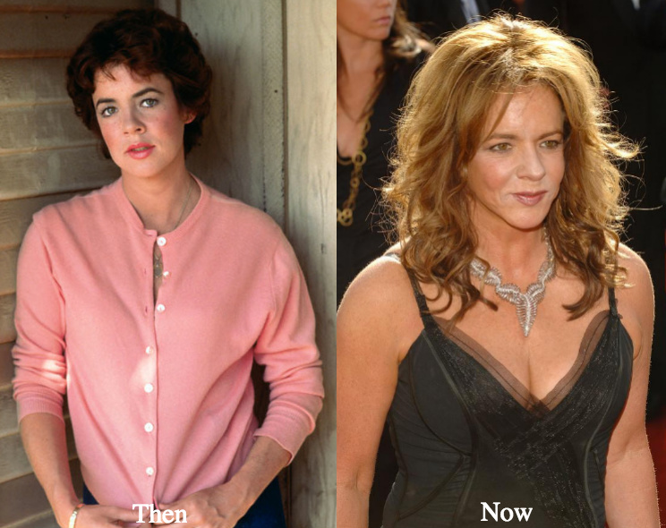 Stockard Channing boob job before and after