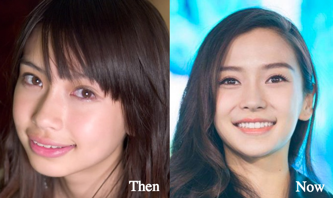 Angelababy plastic surgery before and after photos