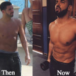 Drake Plastic Surgery Before and After Photos